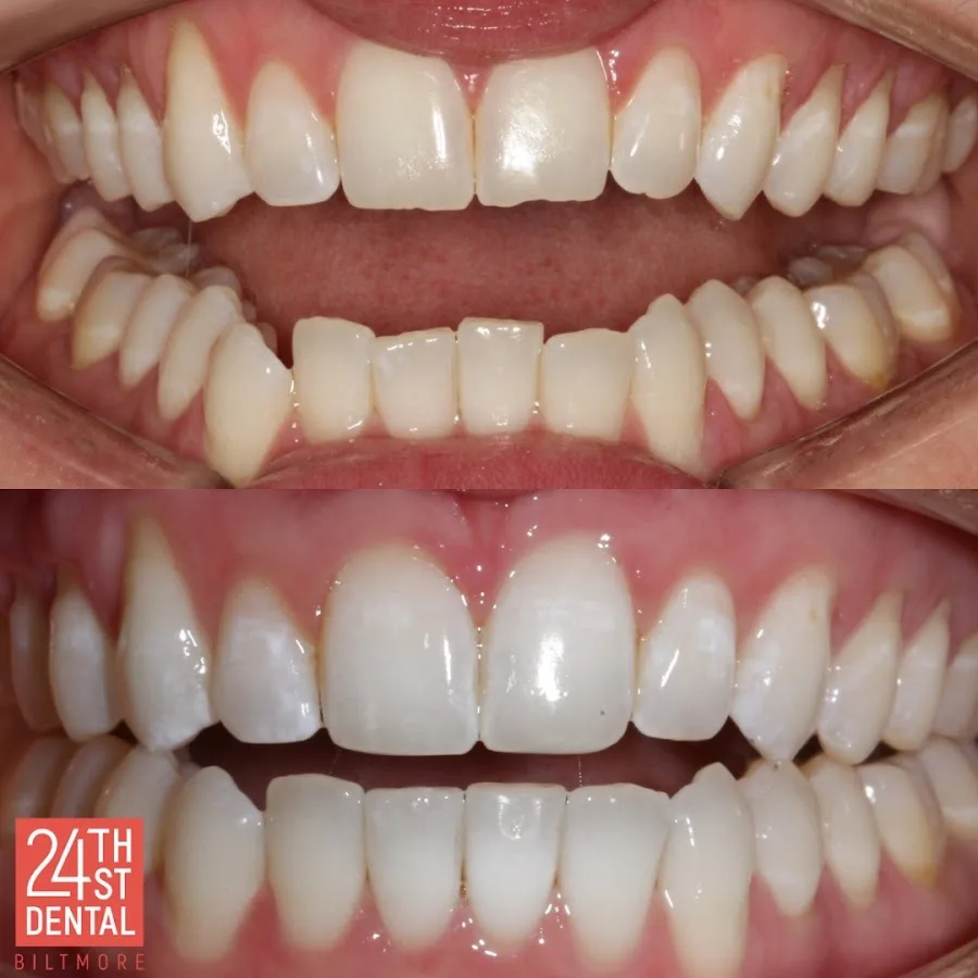 24th Street Dental Biltmore — photo 2