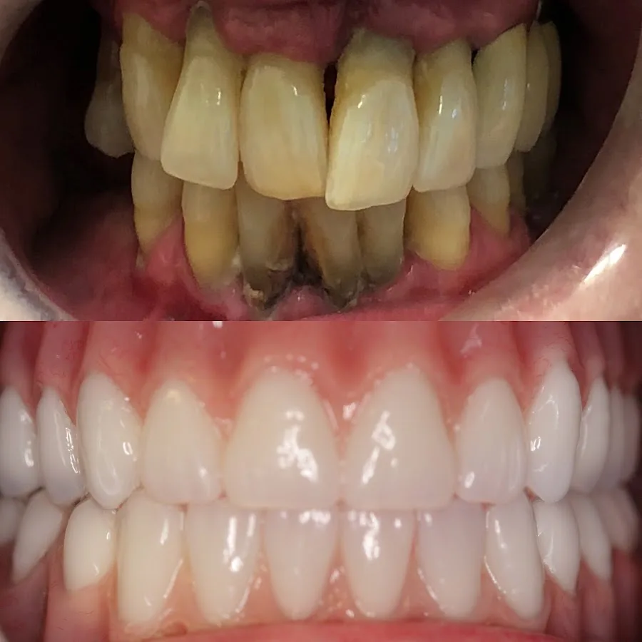 4M Dental Implant Center - Las Vegas — photo 2