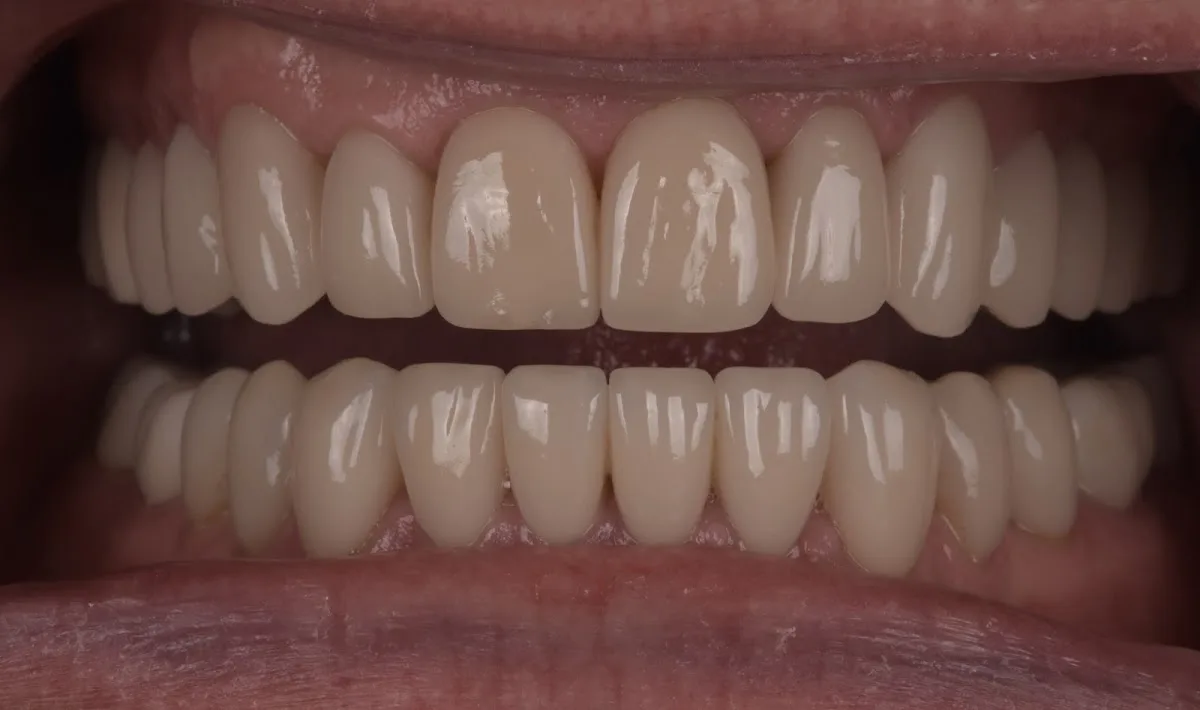 Above & Beyond Dentistry & Implants — photo 1