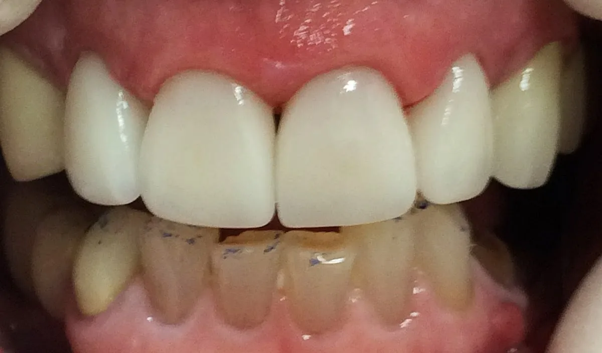 Absolute Dental – Double Diamond — photo 4