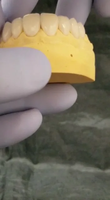 Patient consultation and dental planning discussion