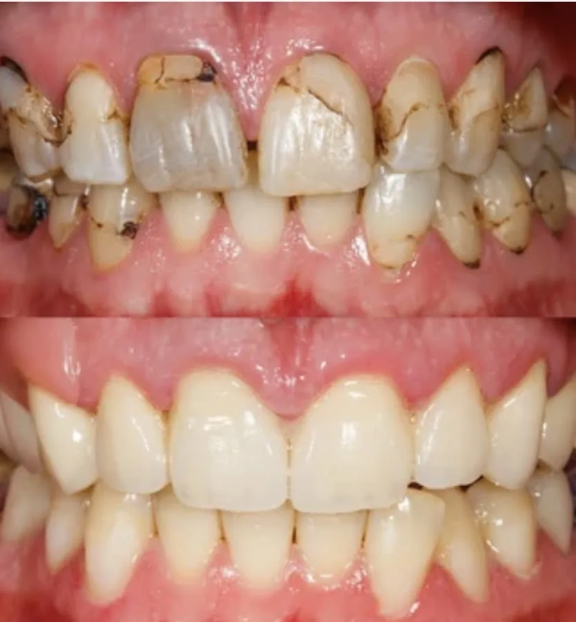 Advanced Dental Care & Aesthetics | Dental Implants Cleveland — photo 3