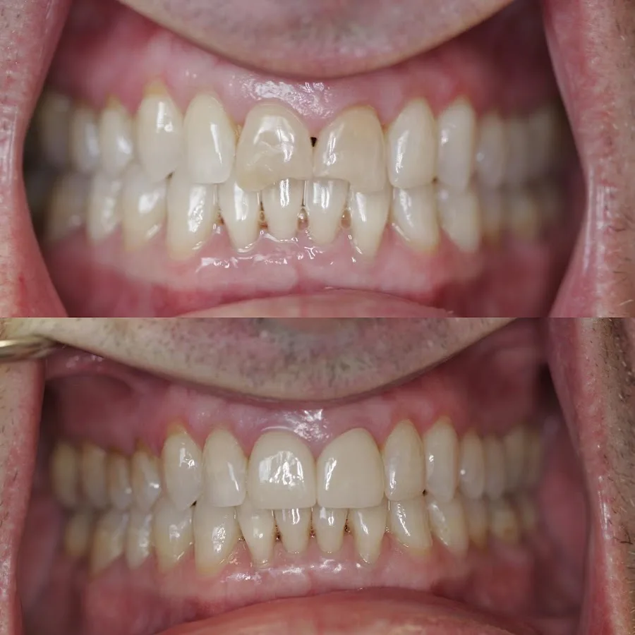 Advanced Dental Care - Tacoma — photo 4