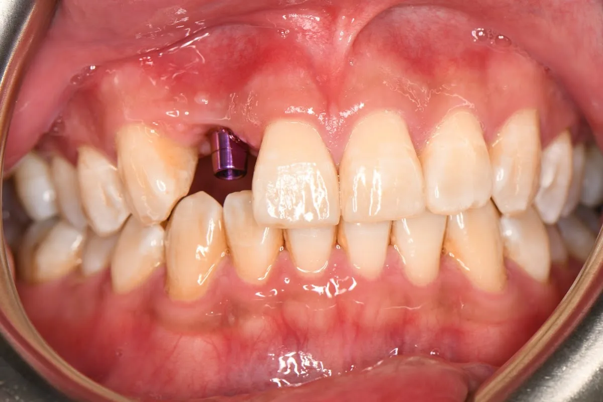 Advanced Dental Cosmetics — photo 5