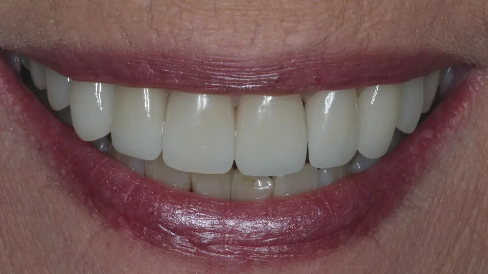 Aesthetic Dentistry of San Diego / Martin P. Abelar DDS — photo 4