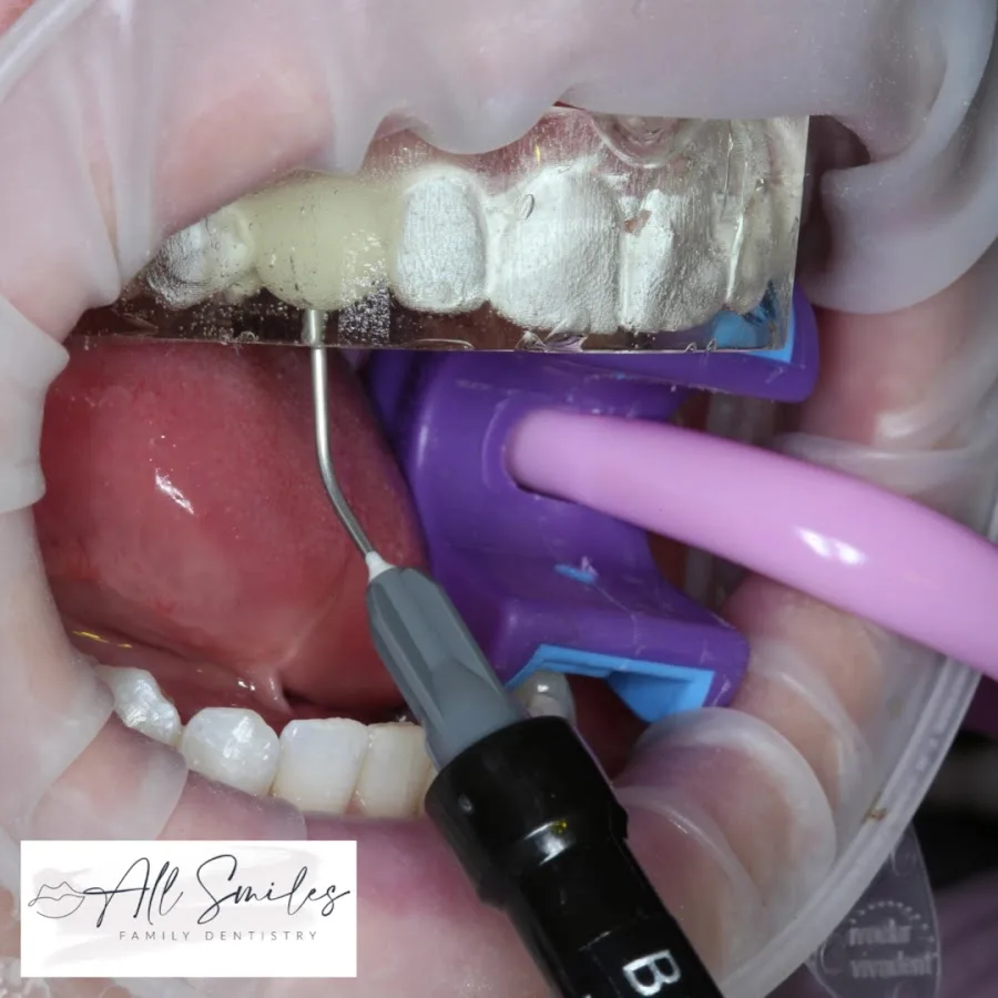 All Smiles Family Dentistry — photo 3