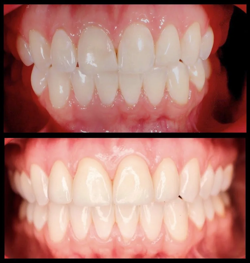 Allure Dental Chicago - Michigan Ave — photo 2