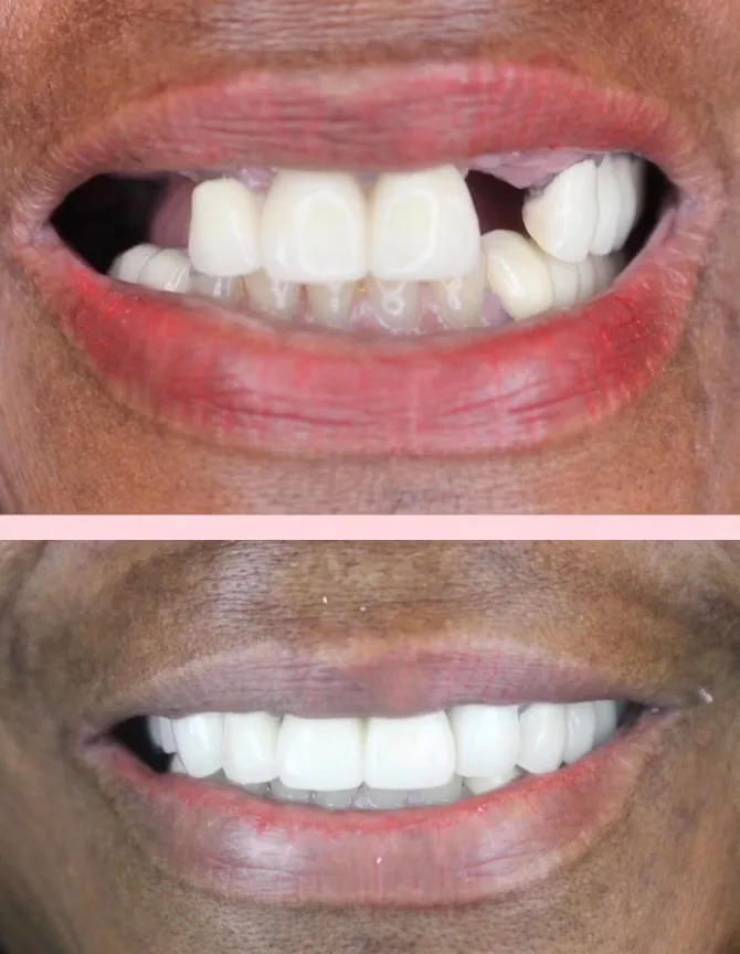 Allure Dental Chicago - Michigan Ave — photo 3