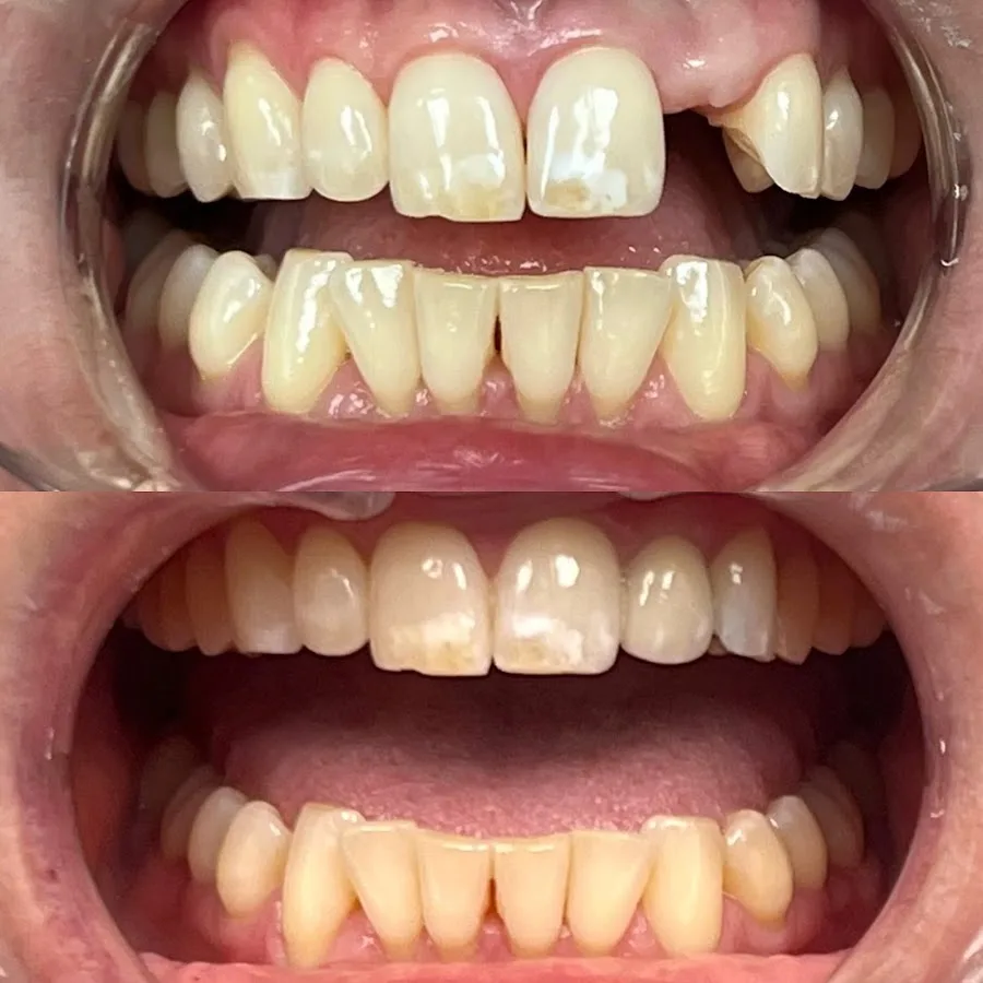 Allure Dentistry — photo 3