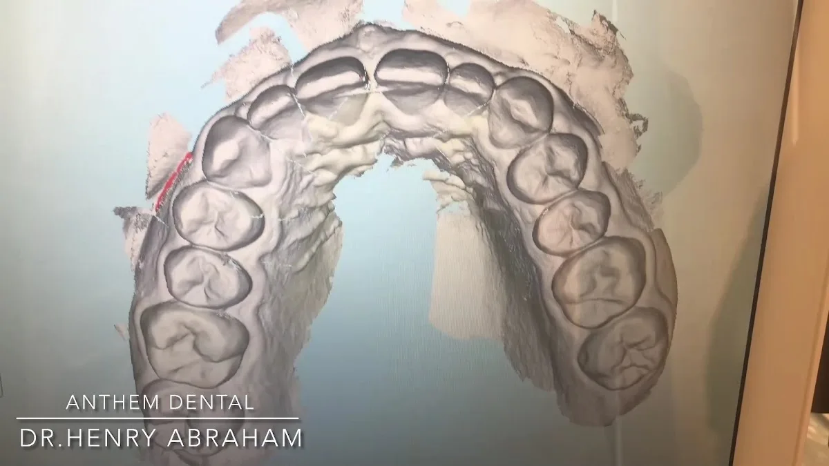 Anthem Dental – Riverside & Moreno Valley — photo 3