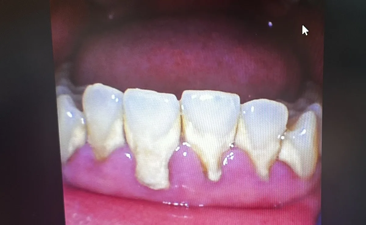 Aquila Dental — photo 2