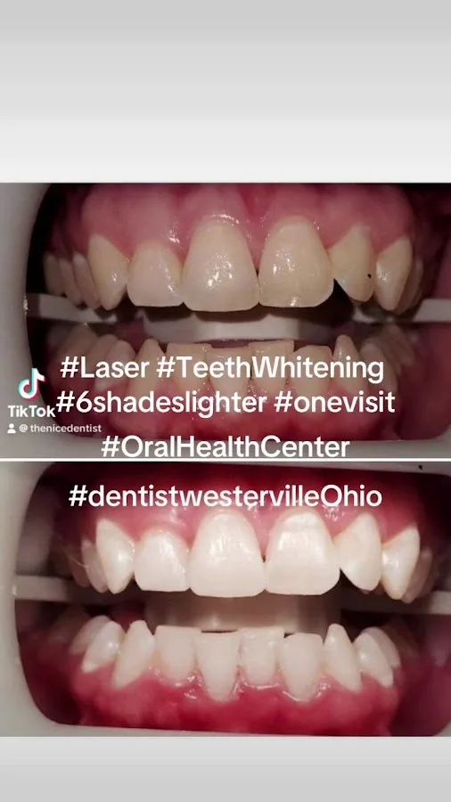 Arch City Dental - Westerville — photo 5