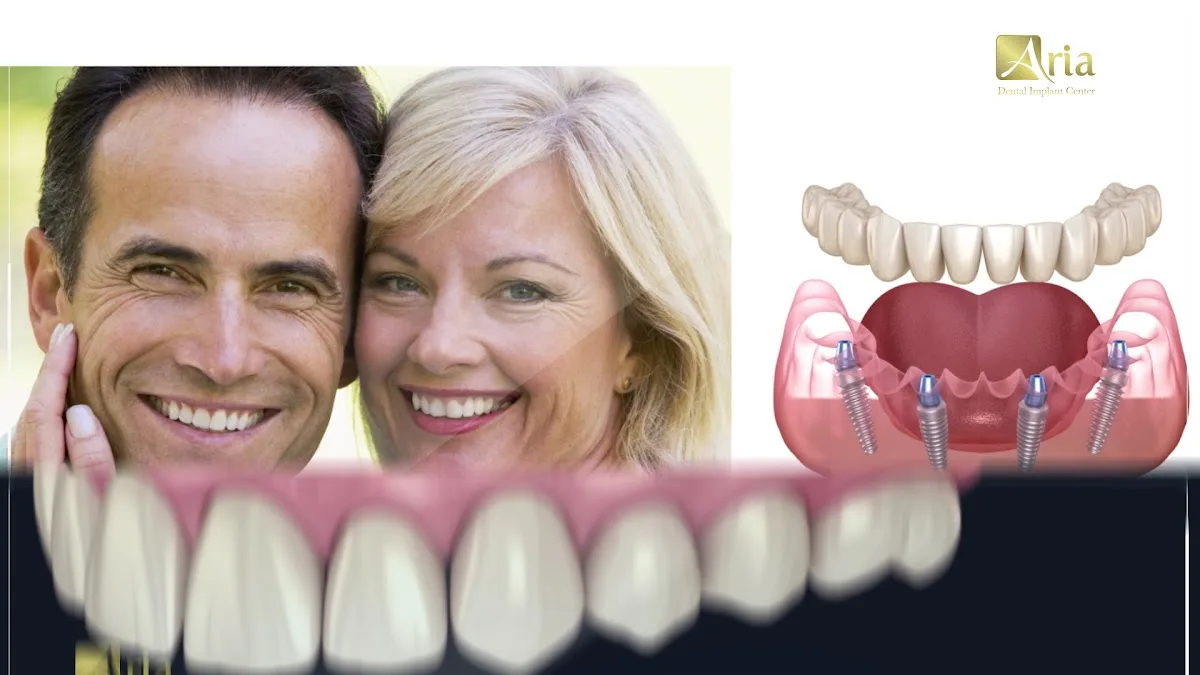 Aria Dental Implant Center — photo 3