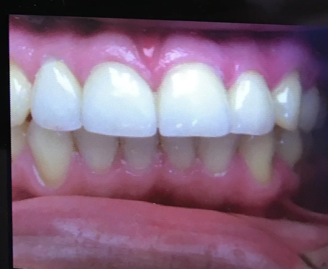 Aspen Dental - Lawrence, NJ — photo 5