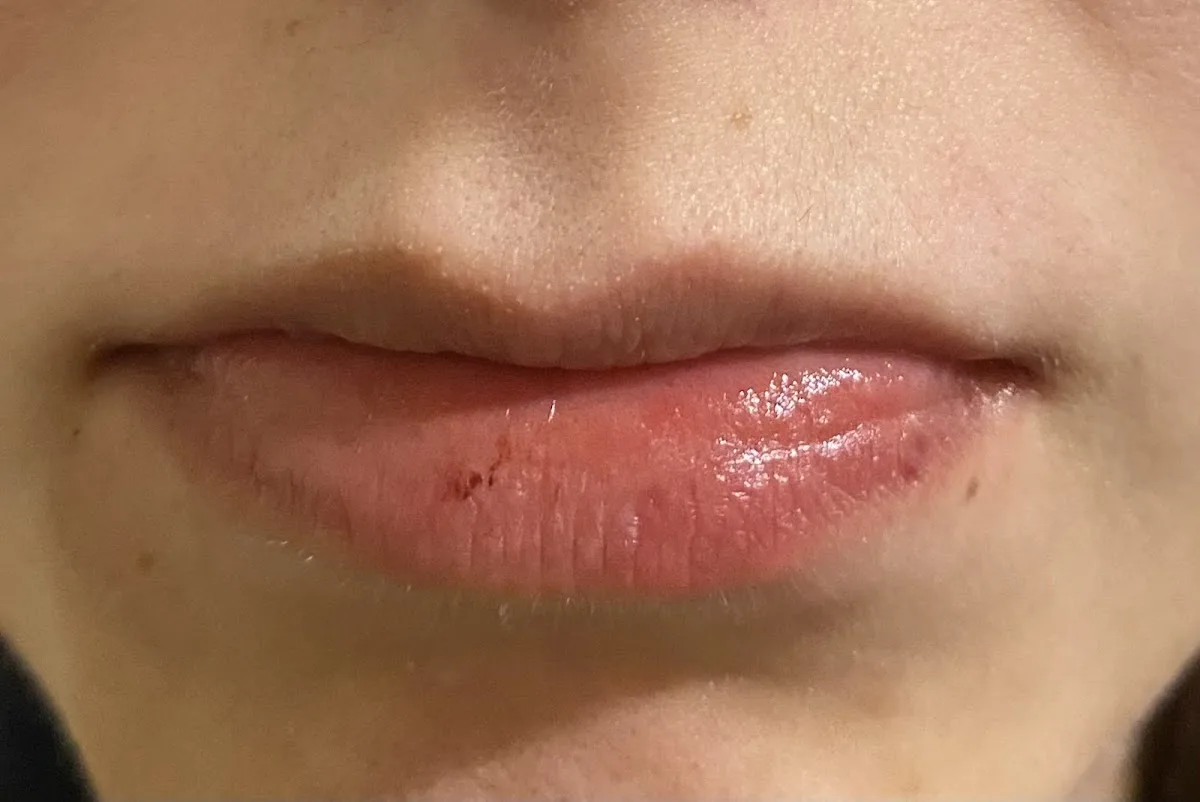 Aurora Sonrisa Dental — photo 2