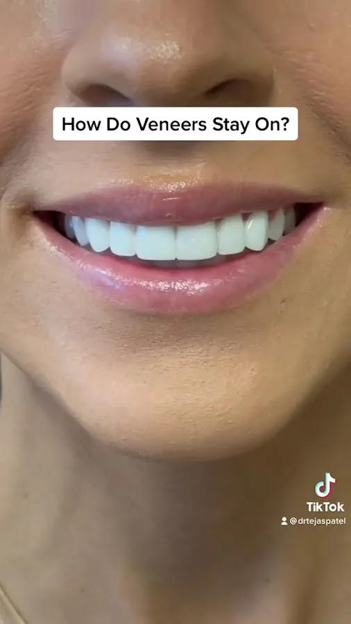 Austin Cosmetic Dentistry by Tejas Patel, DDS — photo 3