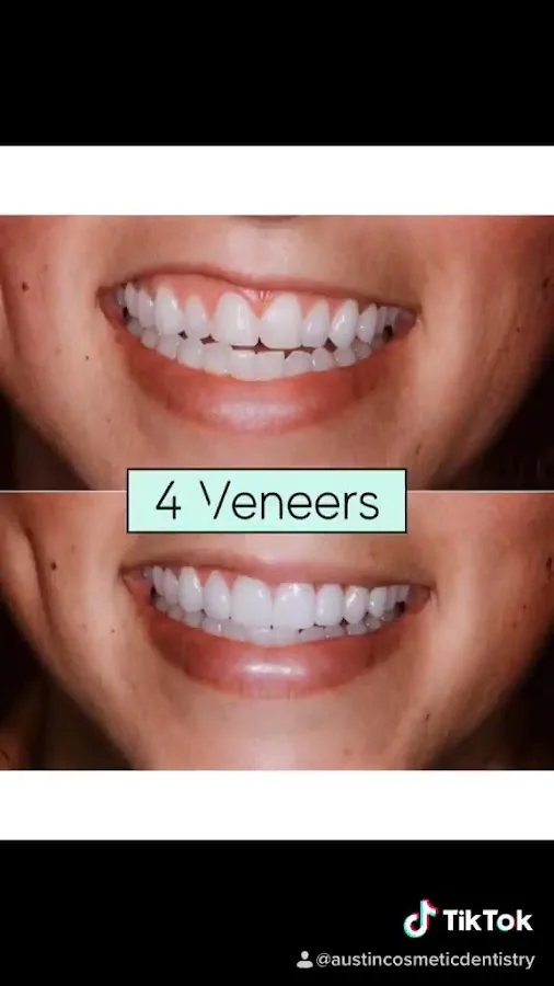 Austin Cosmetic Dentistry by Tejas Patel, DDS — photo 4