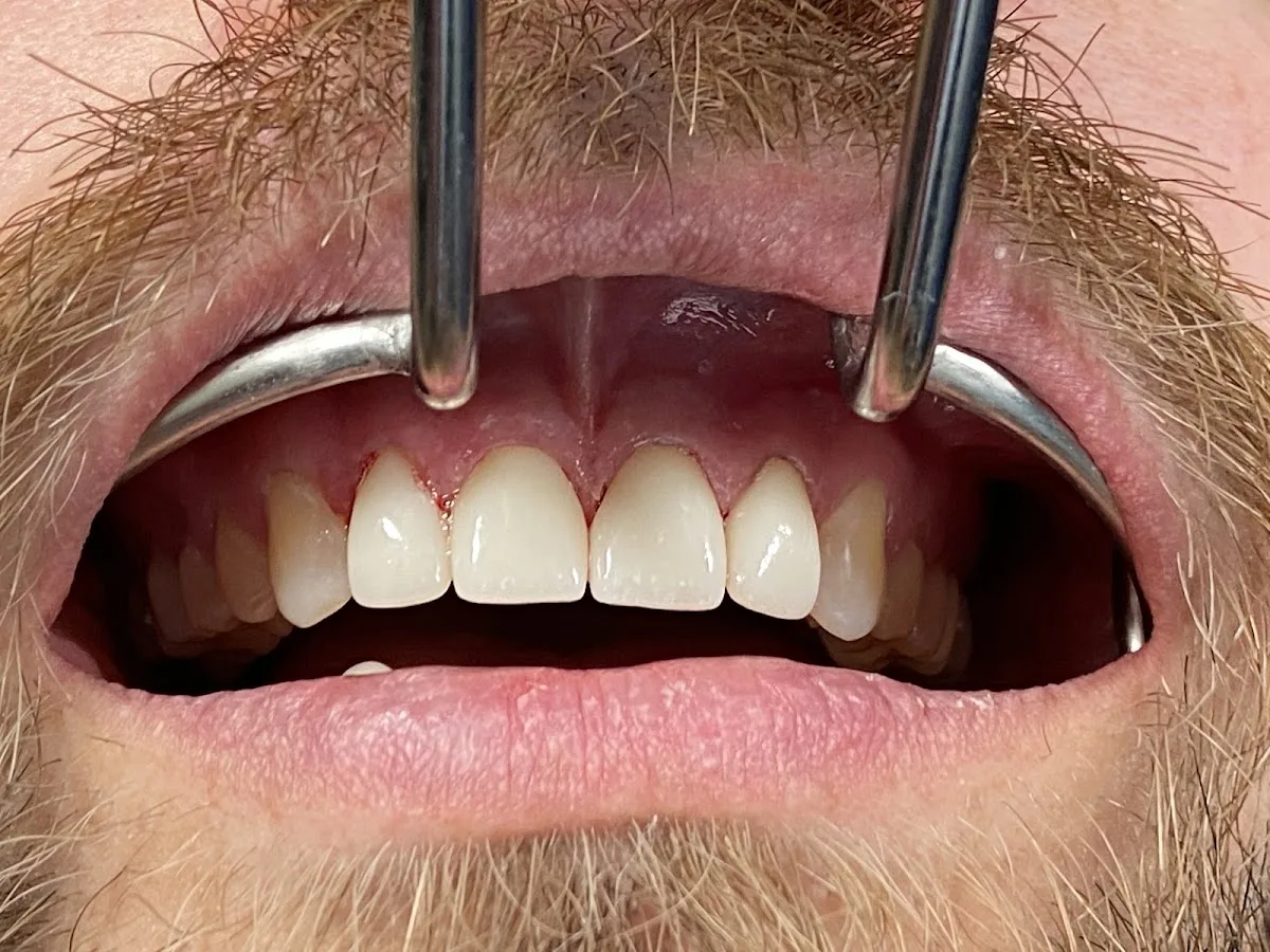 Avenues Dentistry — photo 2