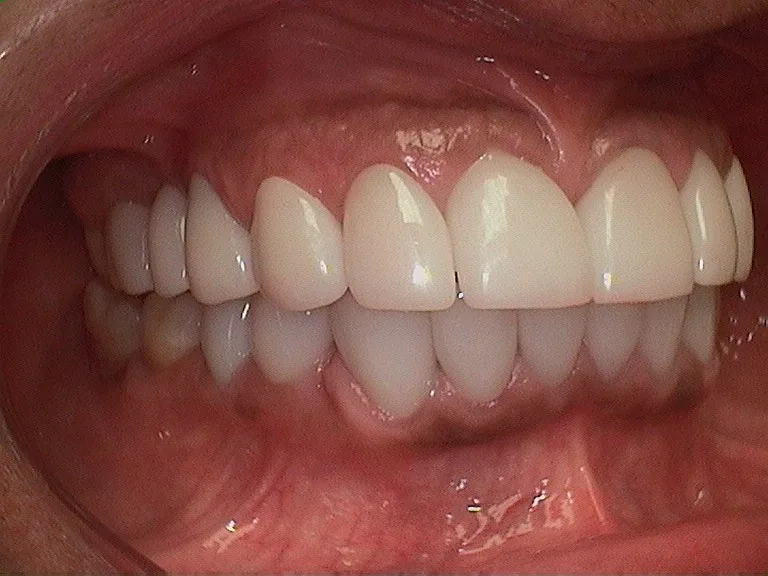 Bakersfield Smile Design | Dentist Dr. Kenneth W Krauss DDS — photo 2