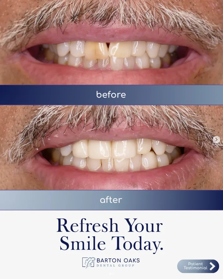 Barton Oaks Dental Group — photo 4