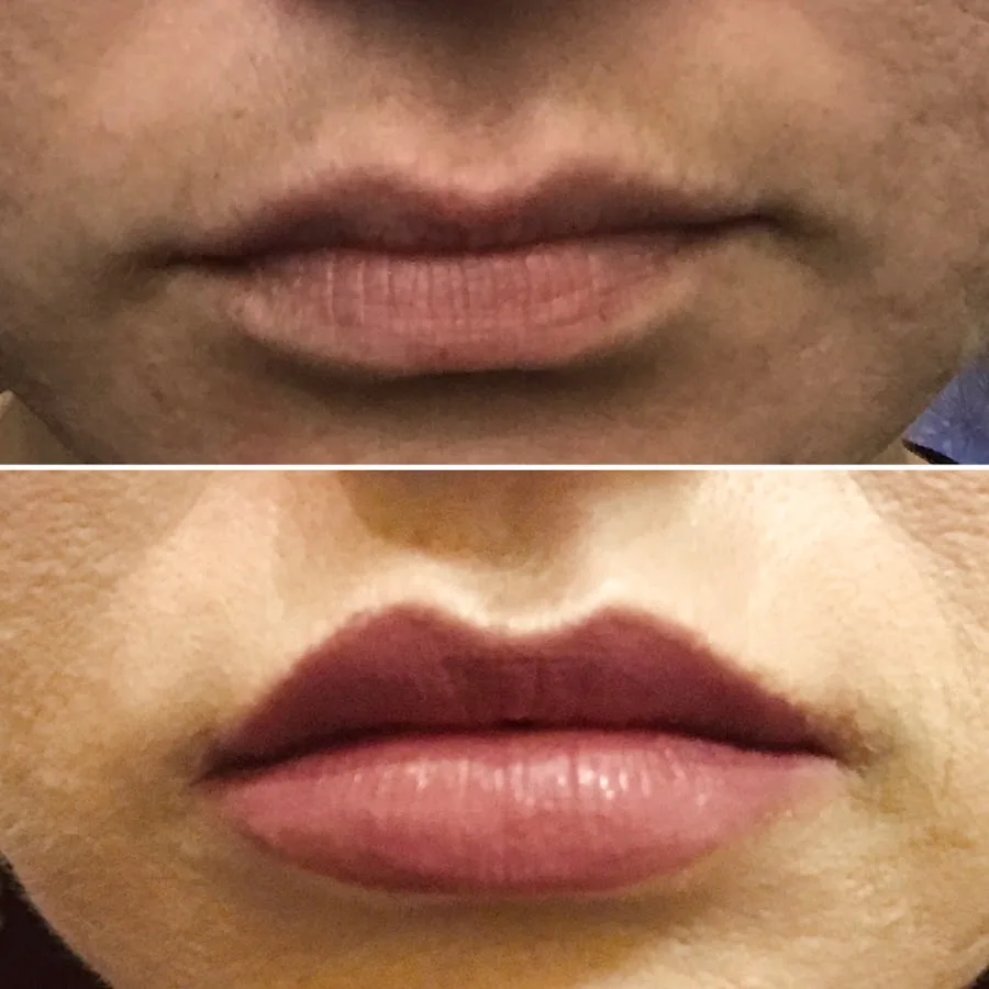 Beacon Family Dentistry — photo 4