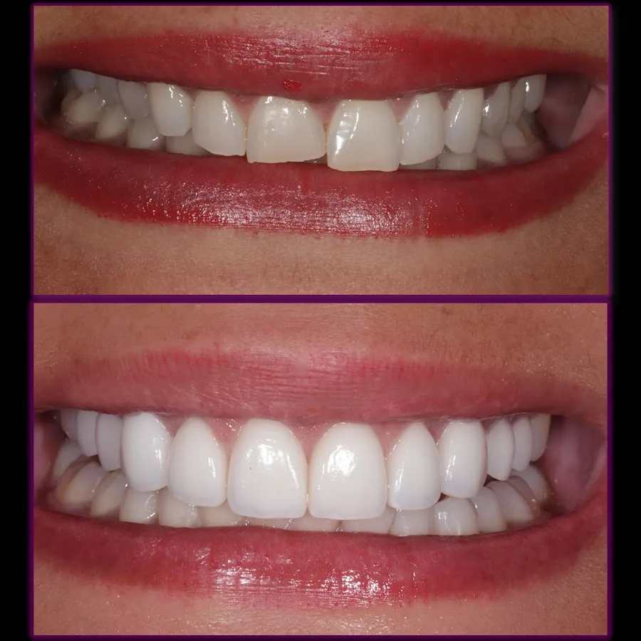Beauty and the Teeth Dentistry: Dr. Diana Tadros