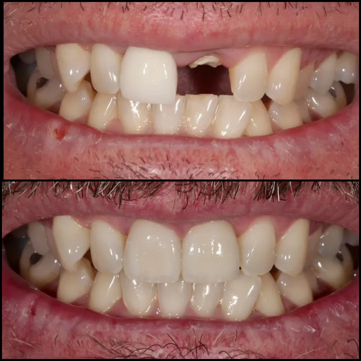 Beauty and the Teeth Dentistry: Dr. Diana Tadros — photo 4