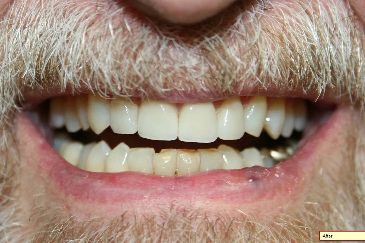 Bellano Dental Health - East Memphis — photo 4