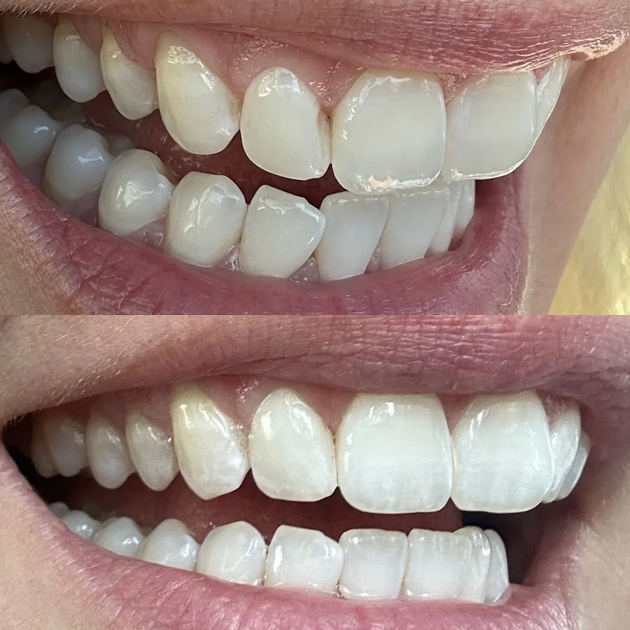 Beverly Grove Dentistry