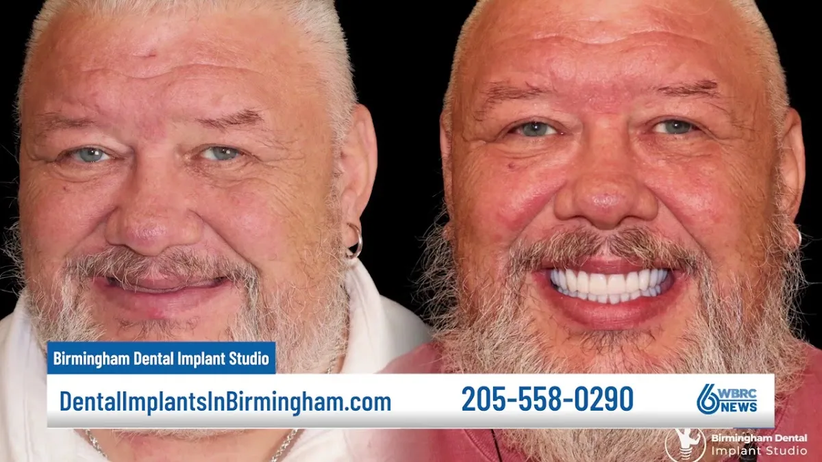 Birmingham Dental Implant Studio — photo 2