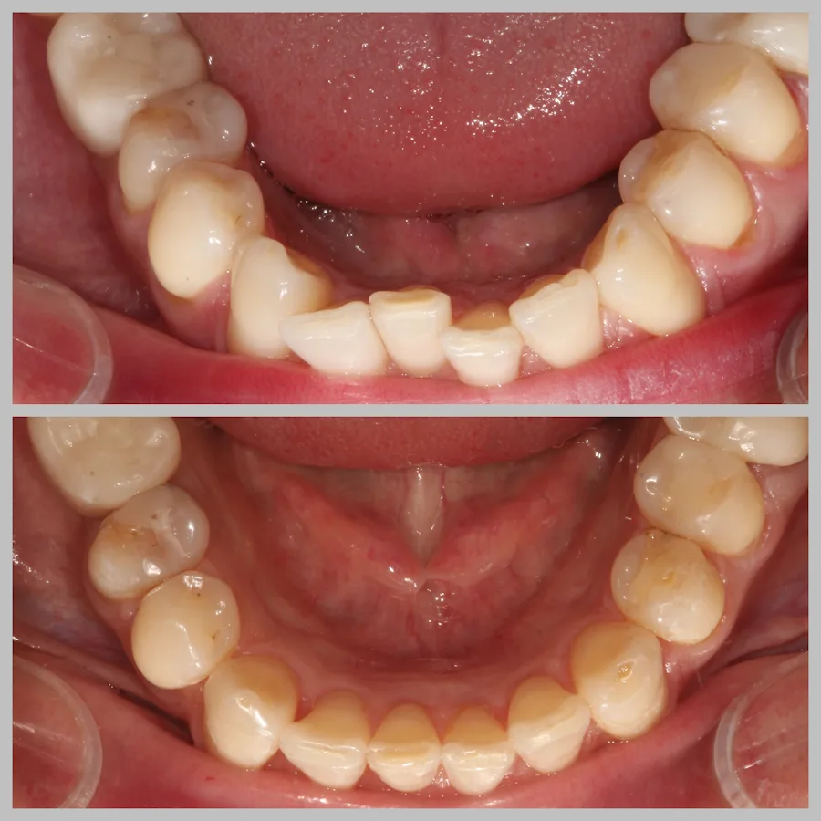 Bright Smile Dental of Brooklyn — photo 2