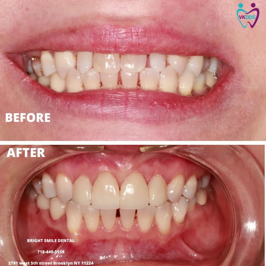 Bright Smile Dental of Brooklyn — photo 3