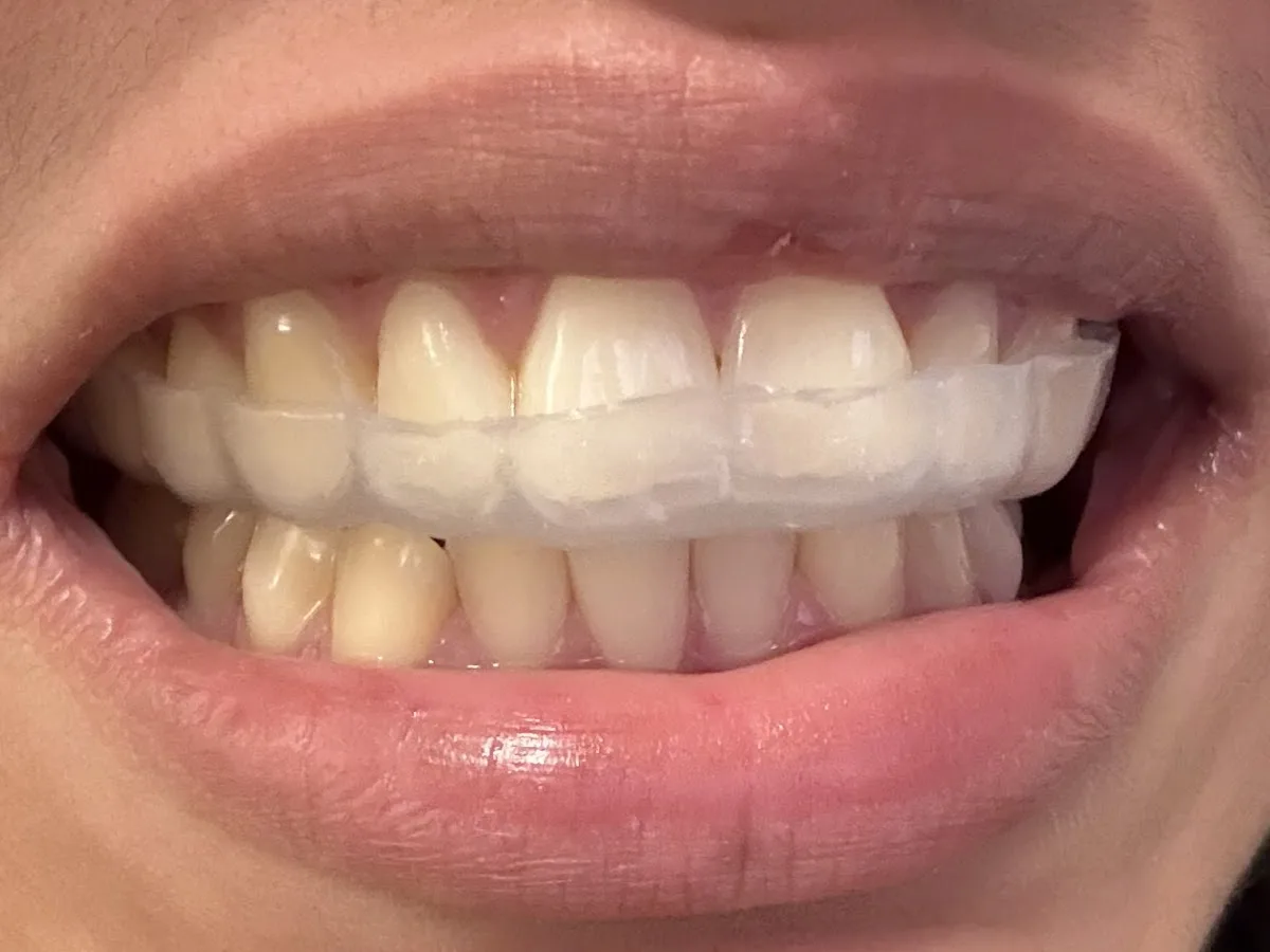 Brooklyn Oak Dental Care — photo 3