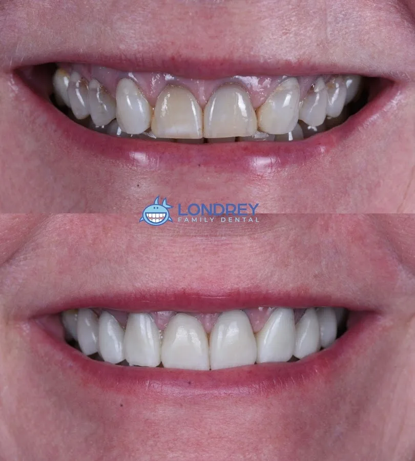 Brown, Reynolds, Snow, LeNoir Dentistry — photo 4