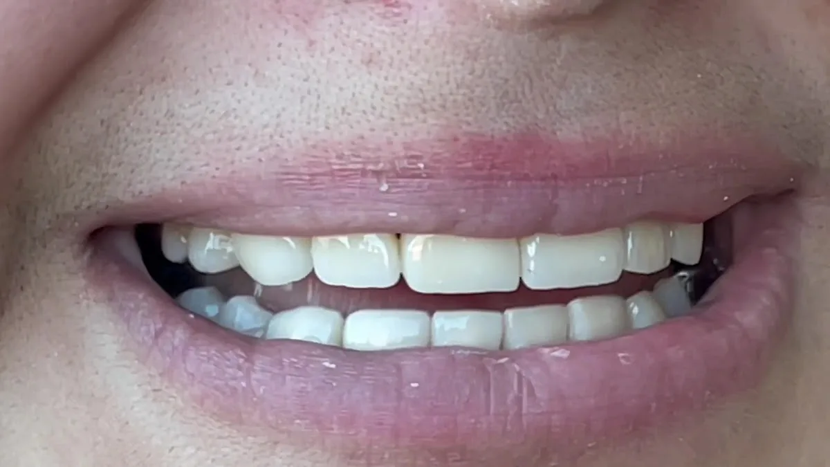 Buffalo General Dentistry | Implant, Sedation & Cosmetic — photo 3