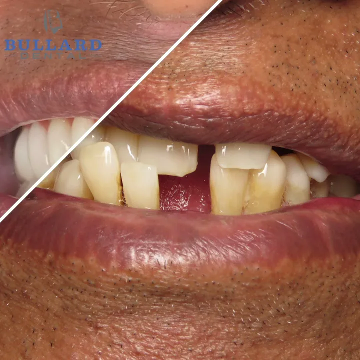Bullard Dental — photo 2