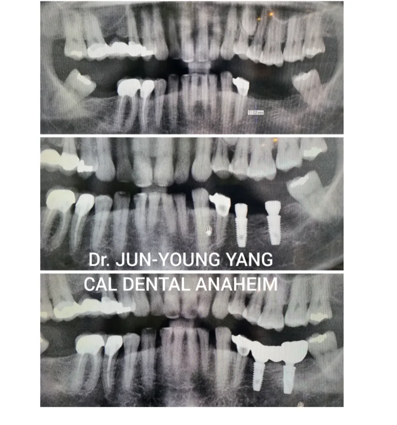 Cal Dental Anaheim — photo 2