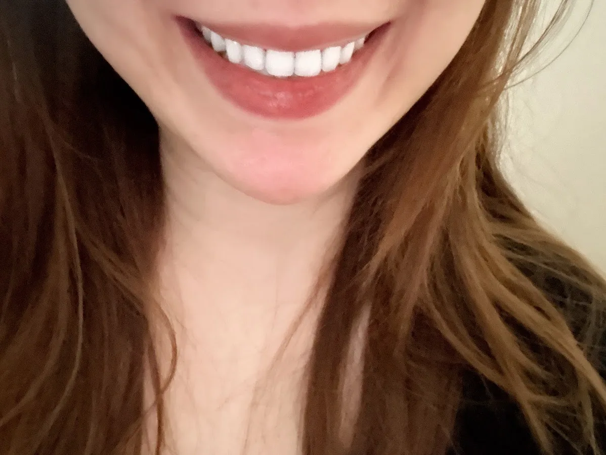 Carolina Smile Spa, Jing Luo DDS, PhD — photo 2