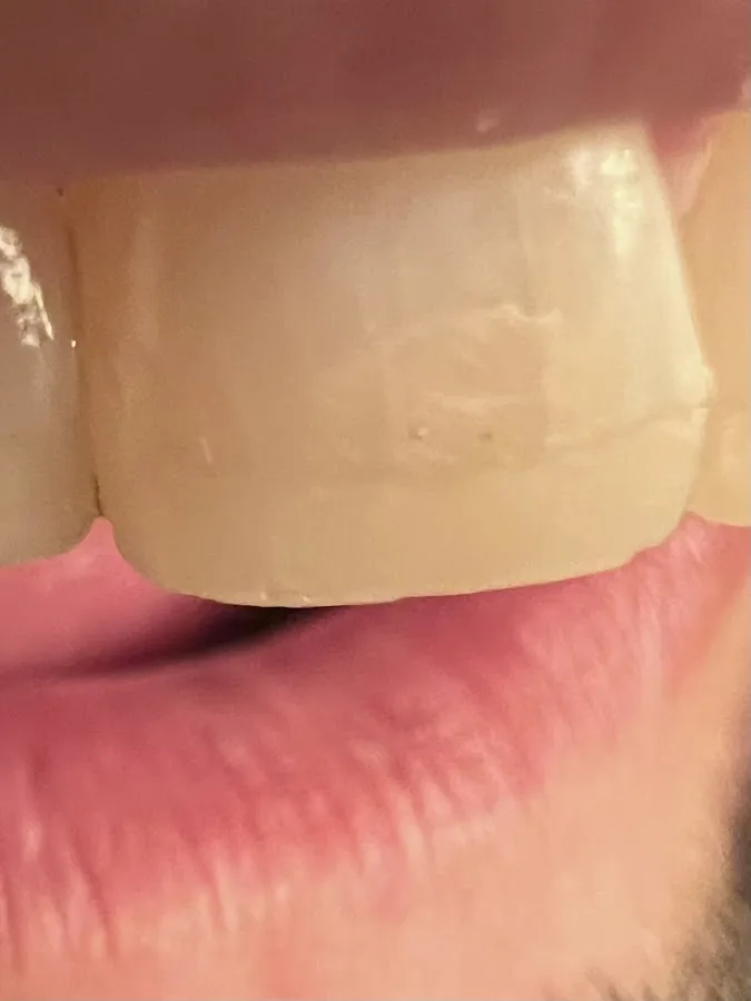 Century Smile Maker — photo 2