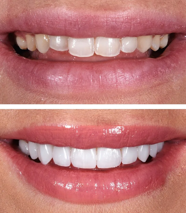 Century Smile Maker — photo 3