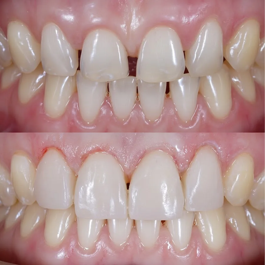 Century Smile Maker — photo 4