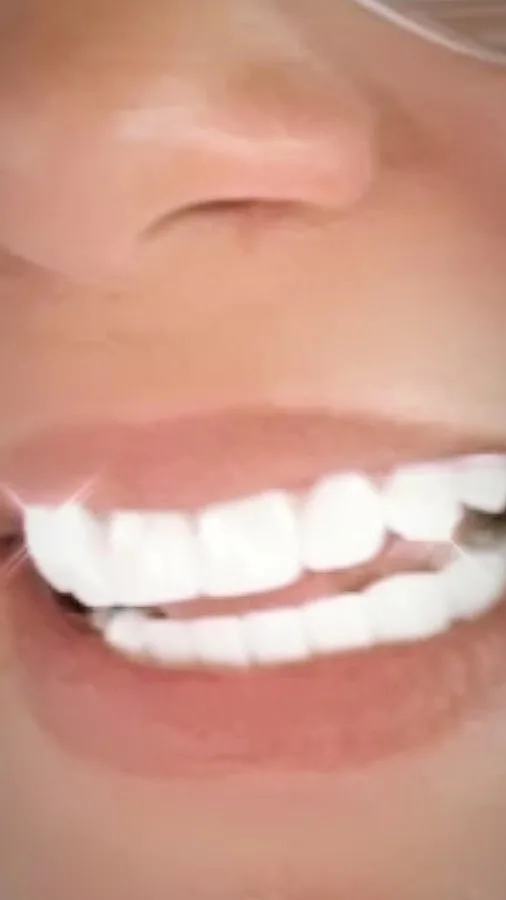 CG Smile — photo 3