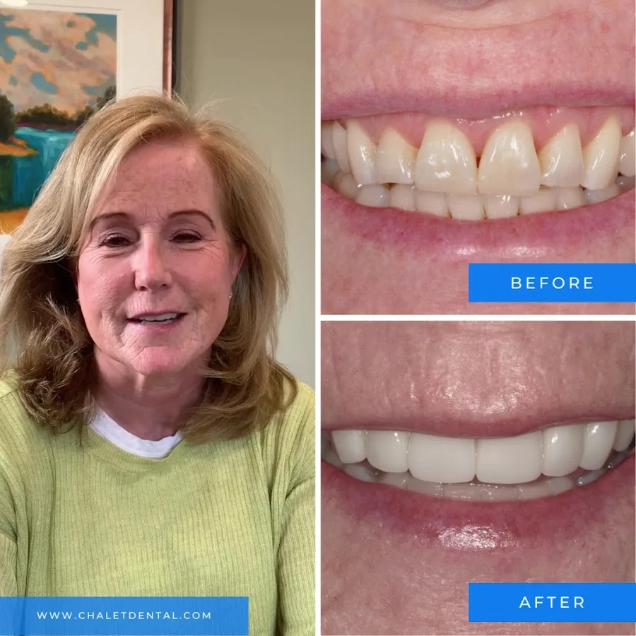 Chalet Dental Care — photo 3