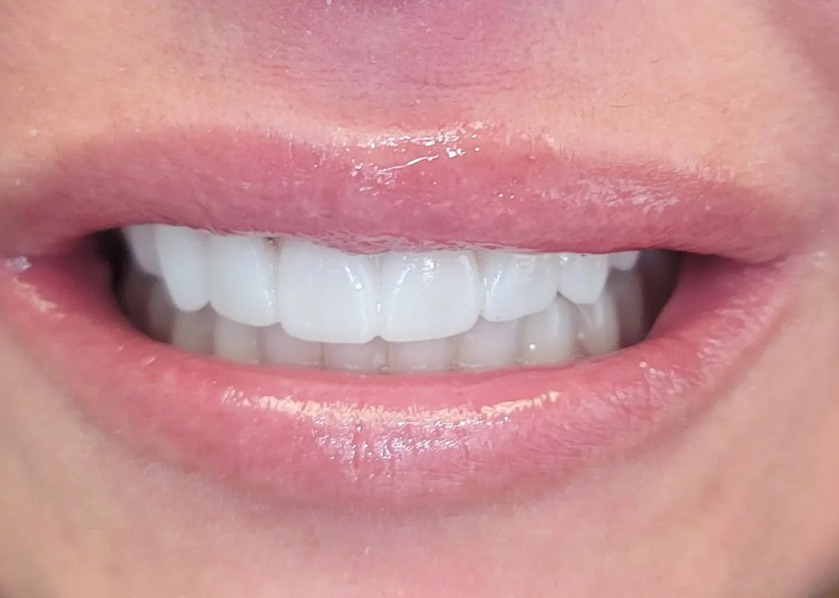 CLE Smiles by Dr. Niki: Nicole Cochran, DDS — photo 2