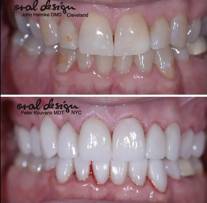 Cleveland Dental Implant Center — photo 5