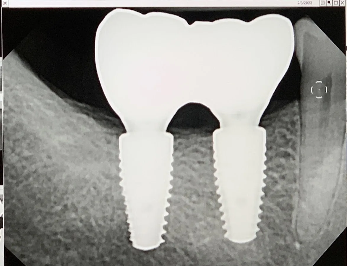 Contemporary Periodontics & Dental Implants — photo 1