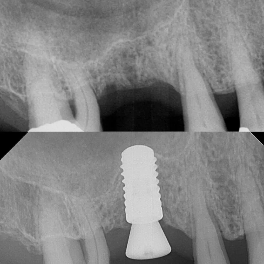 Contemporary Periodontics & Dental Implants — photo 2