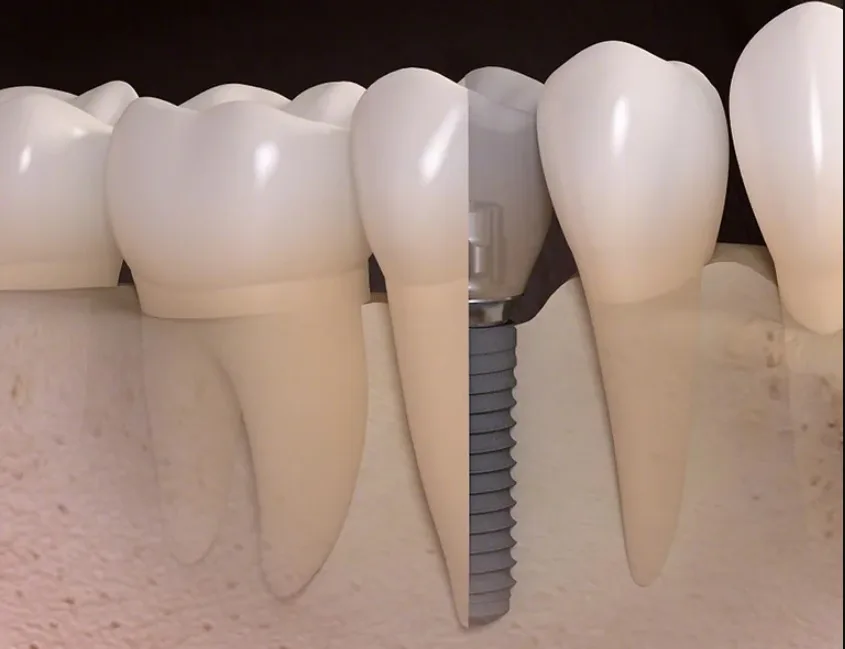 Contemporary Periodontics & Dental Implants — photo 3