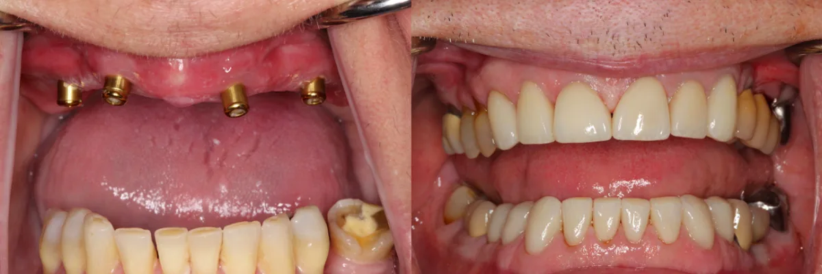 Cosmetic and Implant Dentistry of Connecticut — photo 2