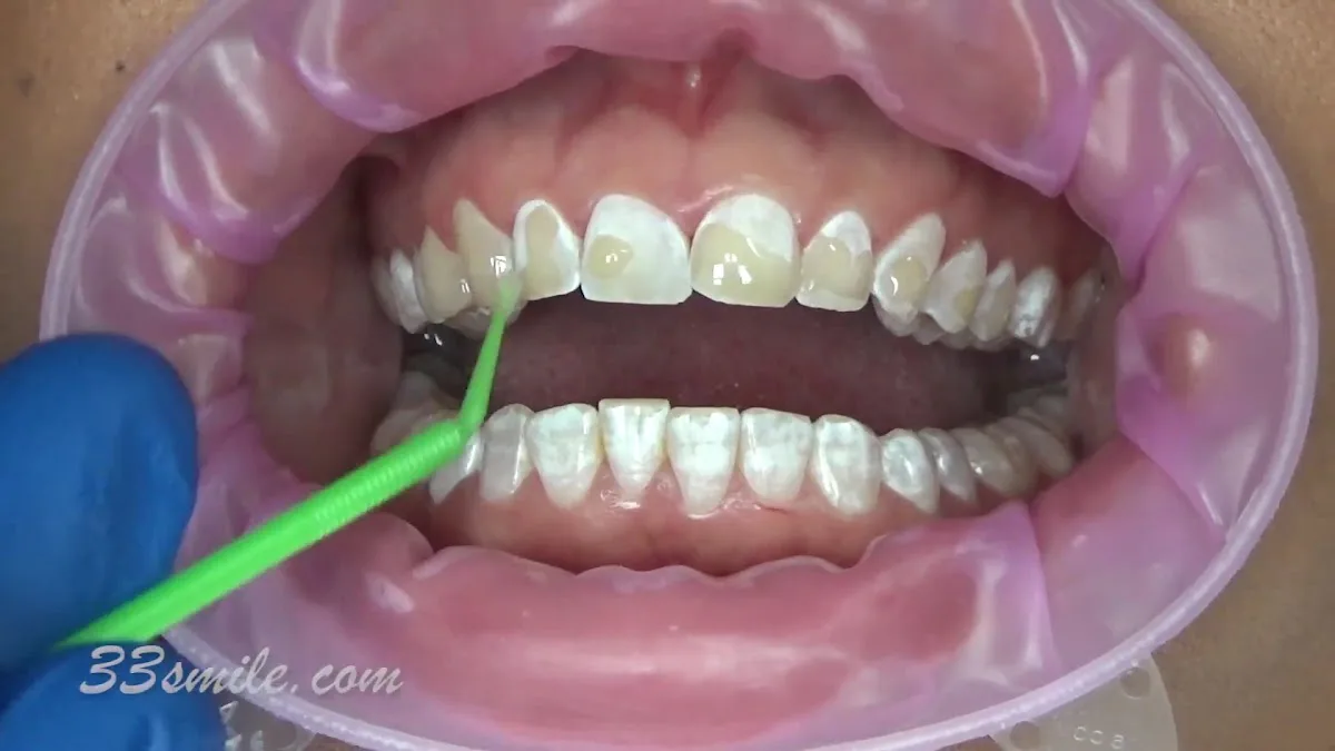 Cosmetic Dental Associates - Medical Center — photo 4